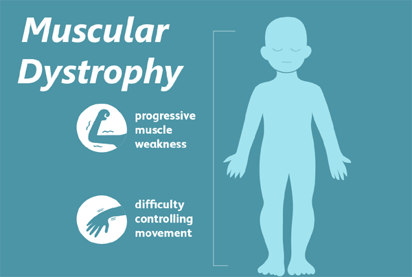 Muscular Dystrophy